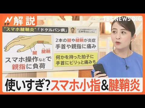 画像 長時間スマホで…痛みや変形“スマホ小指”や腱鞘炎だけでなく、あごが前にズレる“スマホ顎関節症”にも注意【Nスタ解説】｜TBS NEWS DIG